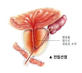 대체 