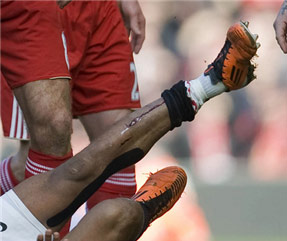 ▲부상을 입은 나니의 다리