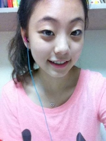 ▲4년만에 치아 교정기를 뺀 곽민정 <출처 - 곽민정 트위터>