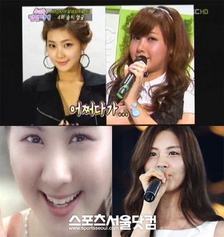 ▲네티즌들 사이에서 외모 기복이 심한 연예인 중 하나로 불리는 솔비(위)와 소녀시대 서현 /사진=MBC 섹션TV연예통신 및 온라인 커뮤니티 캡처, 더팩트DB
