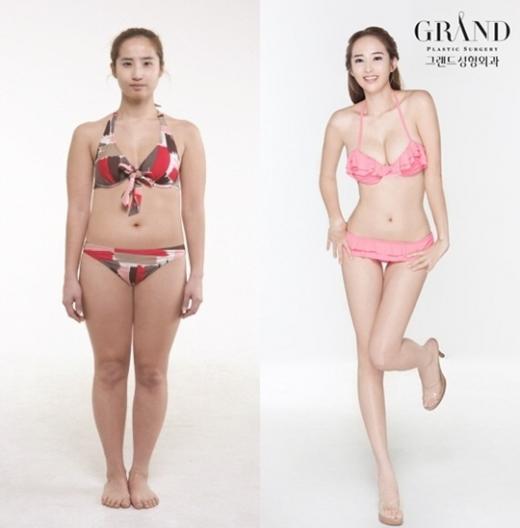 ▲ 전신성형을 통해 달라진 외모를 공개한 최은./그랜드 성형외과 제공