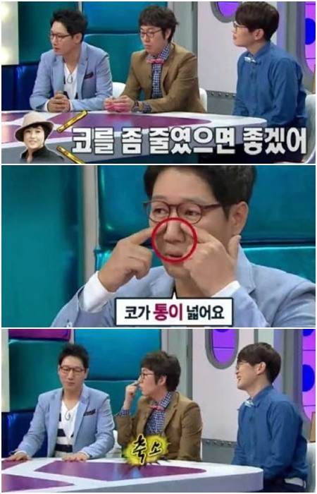 ▲ 방송에서 콧구멍을 줄이는 수술을 했다고 밝힌 지석진./MBC 화면캡처