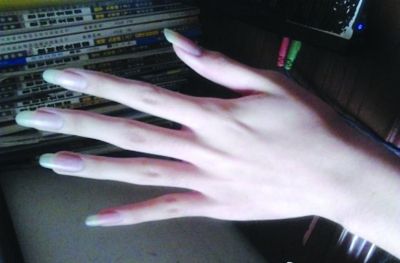 ▲ 네티즌 저우샤오밍이 찍어 올린 손 사진 / 중국 웨이보