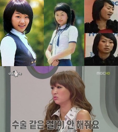 소속사에서 성형수술을 안 해준다고 밝힌 효린의 과거사진(위)./MBC 황금어장-라디오스타 방송 캡처, 온라인 커뮤니티