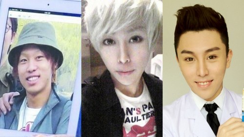 중국 성형중독남 친한의 얼굴 변천사./친한 웨이보, 온라인커뮤니티 캡처