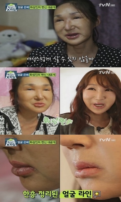 화성인 얼굴은폐녀가 달라진 모습을 공개했다./tvN 화성인 X파일 캡처