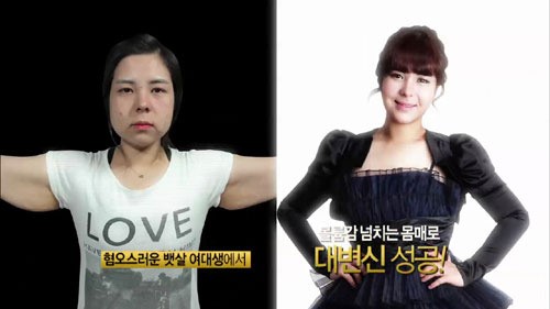 렛미인 시즌2 역대 최고 수술비용이 든 하지영 씨의 수술 전후 모습. / 스토리온 렛미인2 방송화면 캡처
