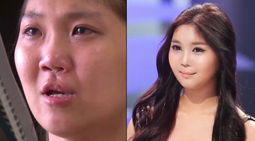 두 얼굴의 외계인녀 최서진 씨가 화제를 모으고 있다. /뷰 성형외과 제공