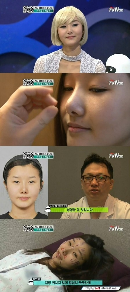 V걸 한송이가 방송을 통해 성형수술 사실을 알렸다./tvN 화성인 바이러스 캡처