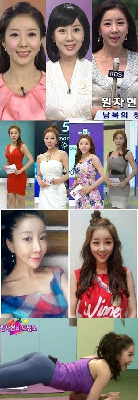 원자현은 과거와 달라보이는 이목구비와 날카롭게 변한 턱선, 엉덩이 보형물 등 많은 의혹을 받았다./온라인 커뮤니티, 원자현 트위터, 손바닥TV 방송화면