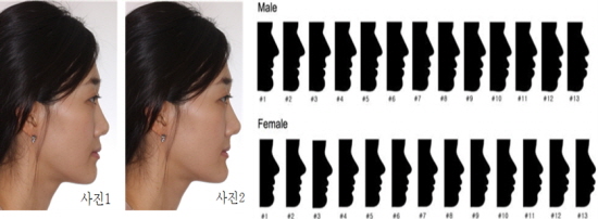 한국인이 좋아하는 옆모습은 젊은성인군(사진1)과 중년(사진2) 이후에서 선호하는 모습이 달랐으며, 조사를 토대로 한 평균 측모 실루엣이 제작됐다