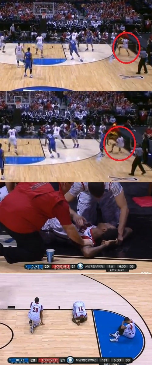 미국대학농구 루이빌대의 케빈 웨어가 지난달 31일 듀크대와 경기에서 다리가 부러지는 끔찍한 상황을 겪었다. / 유튜브 영상 캡처