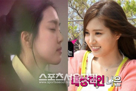 에이핑크 손나은이 과거(왼쪽)과 현재 사진이 화제가 되며 성형 의혹에 휩싸였다. / JTBC 무자식 상팔자, MBC 우리 결혼했어요 캡처