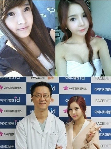 한규리의 양악수술 전, 후 사진이 화제다./아이디병원 제공, 한규리 페이스북