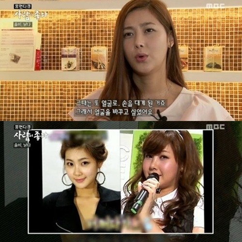 솔비가 성형을 한 이유가 다른 인생을 살고 싶어서라고 언급했다. / MBC 휴먼다큐 사람이 좋다 화면 캡처
