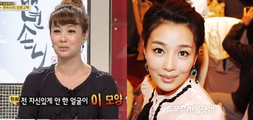 배우 김원흐가 성형수술 사실을 부인하며 자연미인이라고 밝혔다. / SBS 방송화면