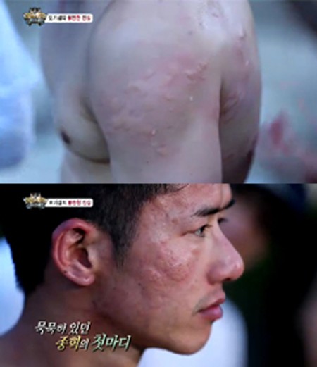 오종혁이 정글의 법칙에서 전투모기에 물려 온몸이 퉁퉁 부어 올랐다. /사진=SBS 정글의 법칙 방송 화면 캡처