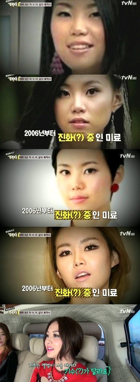 미료가 자신의 성형에 따른 발전에 관해 쿨하게 이야기하고 있다. /tvN 택시 방송 캡처