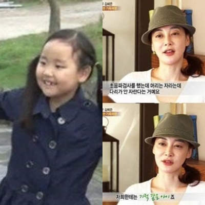 왜소증 원인이 누리꾼들 사이에서 관심을 모았다. / MBC '기분 좋은 날' 방송 캡처