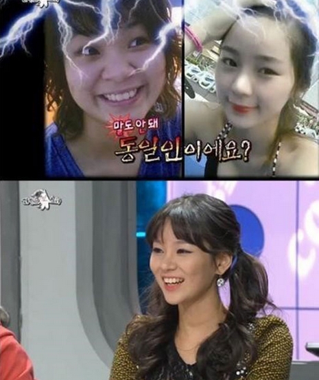 맹승진 성형전 사진 공개에 눈과 코만 했다고 말하고 있다. / MBC 방송화면