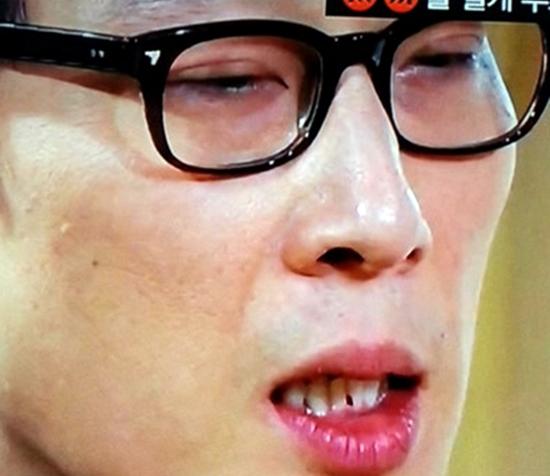 방송인 이휘재가 지난 6일 오후 방송된 SBS 예능프로그램 힐링캠프-기쁘지 아니한가에서 앞니에 큼지막한 고춧가루를 끼고 이야기를 진행해 시청자들의 눈살을 찌푸리게 했다./SBS 힐링캠프-기쁘지 아니한가방송 캡처