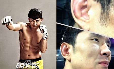 개그맨 윤형빈 귀 모양 변화 사진이 관심을 모으고 있다/ 로드FC, 윤형빈 트위터