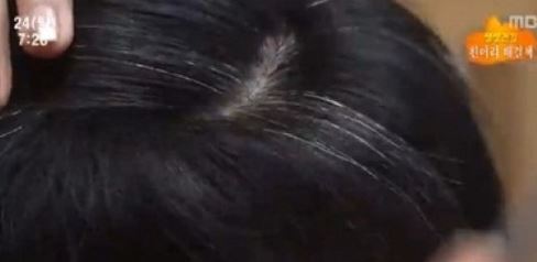 흰머리 생기는 원인이 누리꾼들의 시선을 끌고 있다. / MBC 영상 캡처