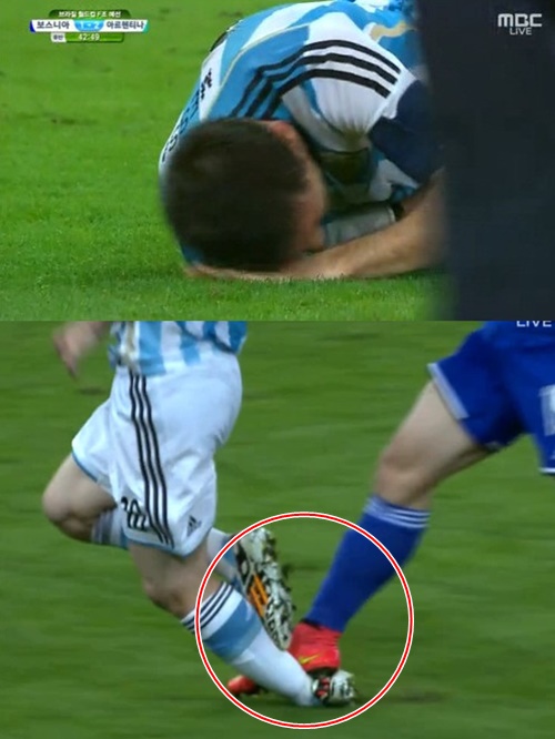 리오넬 메시가 심각한 발목 부상 위기를 면했다. / MBC 방송 화면 캡처