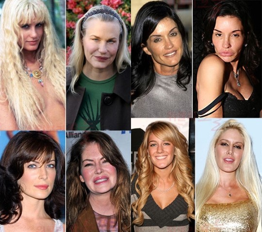 최근 온라인 커뮤니티 게시판에 라라 플린 보일(왼쪽 아래)을 포함한 유명 여배우들의 성형 전후 사진기 공개돼 눈길을 끌고 있다./온라인 커뮤니티