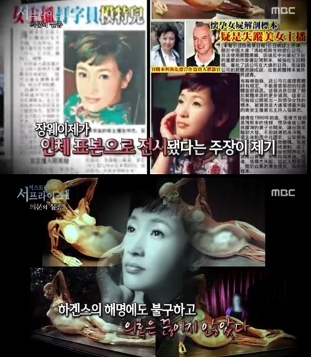 지난 2012년 미국 포틀랜드 인체 표본 전시회에 전시된 임산부 표본이 중국 아나운서 장웨이제라는 주장이 서프라이즈에서 방송됐다./MBC 방송 화면 캡처