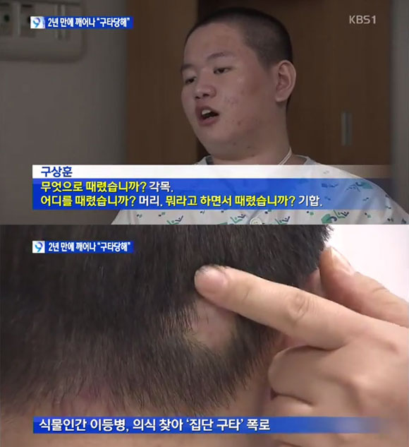 식물인간 이등병으로 1년 9개월을 살았던 구 씨가 드디어 입을 열고 사건의 실상을 밝혔다. /KBS 뉴스 캡처