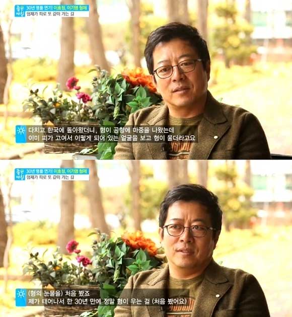 배우 이기영이 촬영 중 얼굴을 다쳐 형 이효정이 눈물을 흘리며 마음 아파했던 에피소드를 털어놨다./SBS 좋은아침 캡처