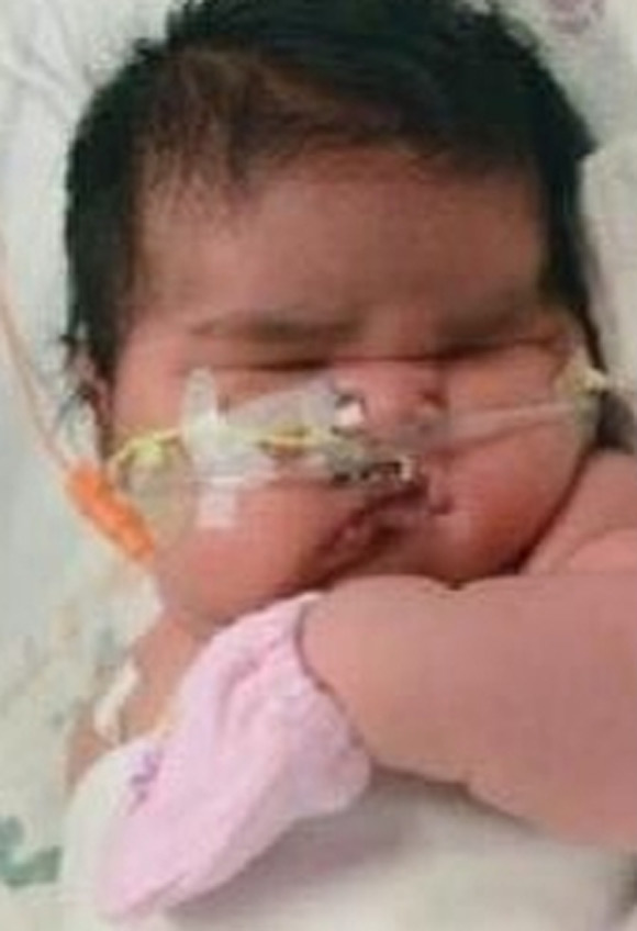 6.4kg 슈퍼 우량아 사진이 공개돼 눈길을 끌고 있다. / YTN 뉴스 캡처