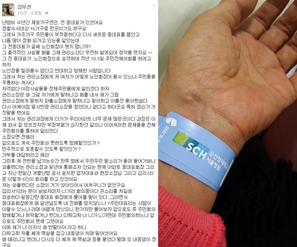 김부선은 부녀회장에게 폭행당했다고 주장하며 관련 사진을 자신의 페이스북에 올렸다. /김부선 페이스북
