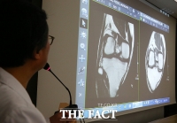 [TF포토] '병역 의혹' 이완구 차남 MRI 촬영 결과 설명하는 이명철 교수