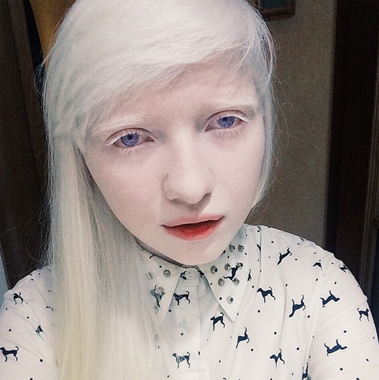 알비노 증후군 모델 나타샤 쿠라모바. 알비노 증후군을 이겨내고 활동을 펼치고 있는 러시아 모델이 눈길을 받고 있다. 알비노 증후군에는 아직까지 명확한 치료법이 없다고 알려졌다. /나타샤 쿠라모바 인스타그램