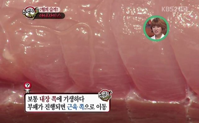 고래회충 조심해야 고래회충에 감염되면 구역질, 통증 등의 증상이 나타난다./KBS2 스펀지 캡처