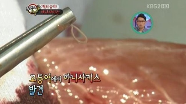 고래회충 주의. 고래회충 급증 소식에 시민들의 각별한 주의가 요구되고 있다. /KBS 방송 화면 캡처
