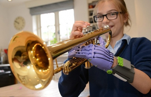 3D프린팅 인공손을 선물받은 라라 핀콧./데일리메일