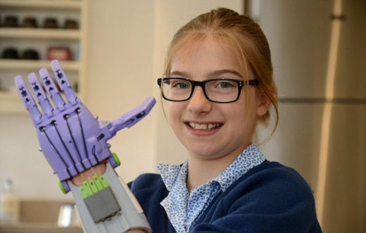 3D프린팅 인공손을 선물받은 라라 핀콧./데일리메일