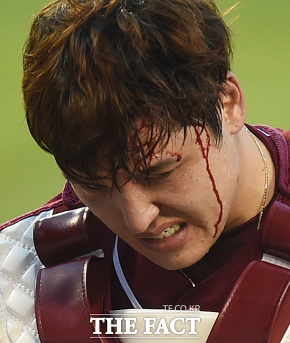 넥센 포수 박동원이 3회말 두산 양의지의 배트에 머리를 맞아 출혈이 생겨 피를 흘리고 있다.