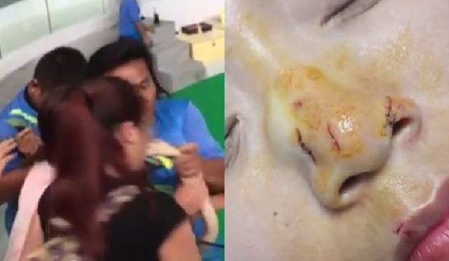 중국 20대 여성이 뱀과 입을 맞추려다가 물리는 사고를 당했다. /유튜브 영상 캡처