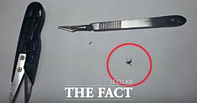 유튜브에 모기 침을 제거하는 영상이 주목을 받고 있다. 이 영상에서 모기의 침은 잔혹하게 절단되고야 말지만 모기가 살생하되지는 않는다. 그럼에도 모기 학대를 놓고 누리꾼들 사이에서 설전이 뜨겁게 일었다. /유튜브 영상 캡처