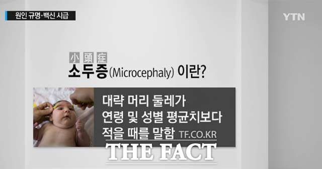 소두증을 유발하는 지카바이러스가 중남미 24개국으로 확산하면서 지카바이러스에 대한 주의가 요구되고 있다. /YTN 방송 캡처