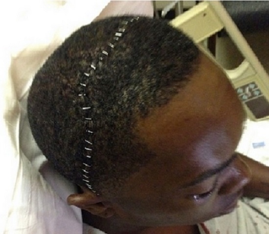 머리에 핀이… 메이저리그 광속구 마무리 채프먼은 지난 2014년 시범경기 도중 타구에 안면을 맞았다. / 조 홈페이지 캡처