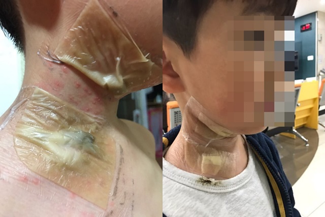 대구 어린이 폭죽테러사건 아이가 무서워한다. 7일 온라인 커뮤니티에 올라온 대구 어린이 폭죽테러사건 가해자 가족의 태도에 분노가 일고 있다./온라인 커뮤니티 방송 캡처
