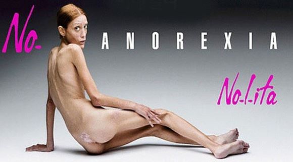 2007년 이탈리아 사진작가 올리비에로 토스카니가 제작한 거식증 반대 캠페인 광고. 사진 속에는 아무 것도 걸치지 않은 이사벨 카로의 모습이 담겼다. 이 광고는 신문과 광고판 등을 통해 많은 사람들에게 거식증의 위험을 알리는 역할을 했다. /NO. ANOREXIA 포스터