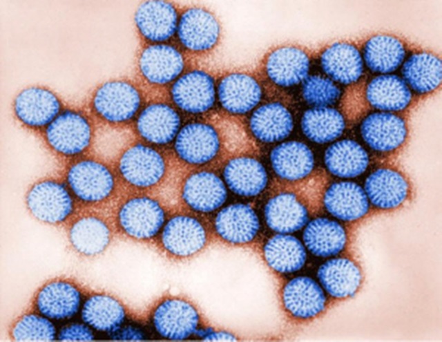로타바이러스의 로타는 라틴어로 바퀴라는 뜻으로 바이러스는 원형 형태를 보이고 있다. /WHO