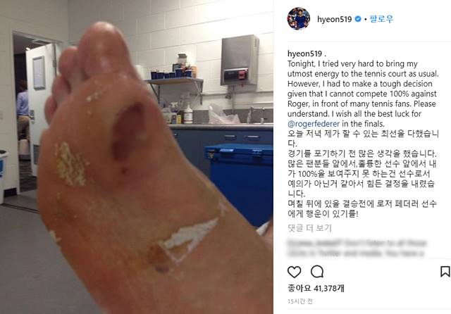 스포츠 선수들의 땀과 노력의 결정체 발 사진. 정현 선수의 발 사진이 주말 각종 포털 사이트에 실시간 검색어를 장식하며 시선을 모았다. 정현 선수의 발 사진 외에 스포츠 선수들의 발 사진도 동시에 눈길을 끌고 있다. /정현 SNS