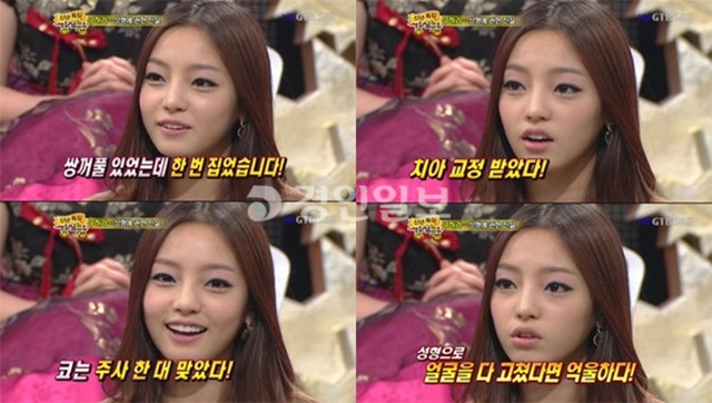 구하라는 2010년 강심장에 출연해 수술 사실을 고백한 바 있다. /SBS 강심장 방송 캡처